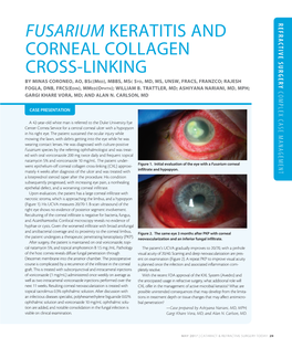 Fusarium Keratitis and Corneal Collagen Cross