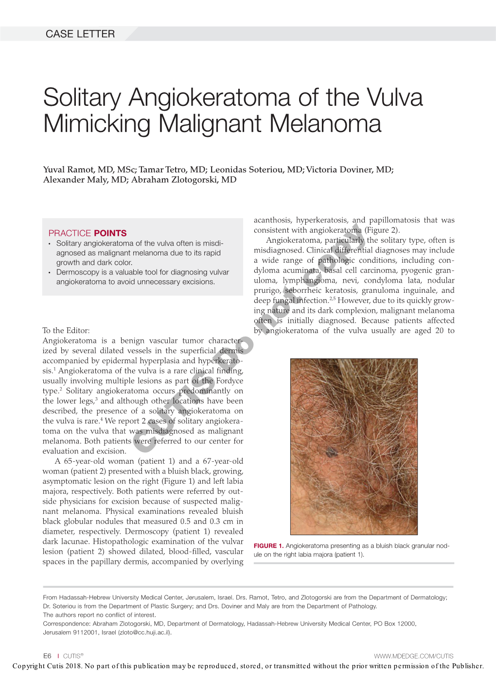 Solitary Angiokeratoma of the Vulva Mimicking Malignant Melanoma