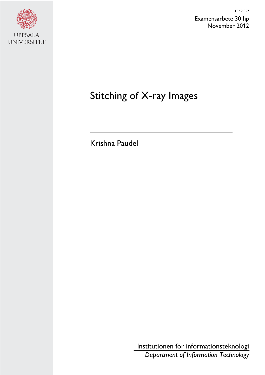 Stitching of X-Ray Images