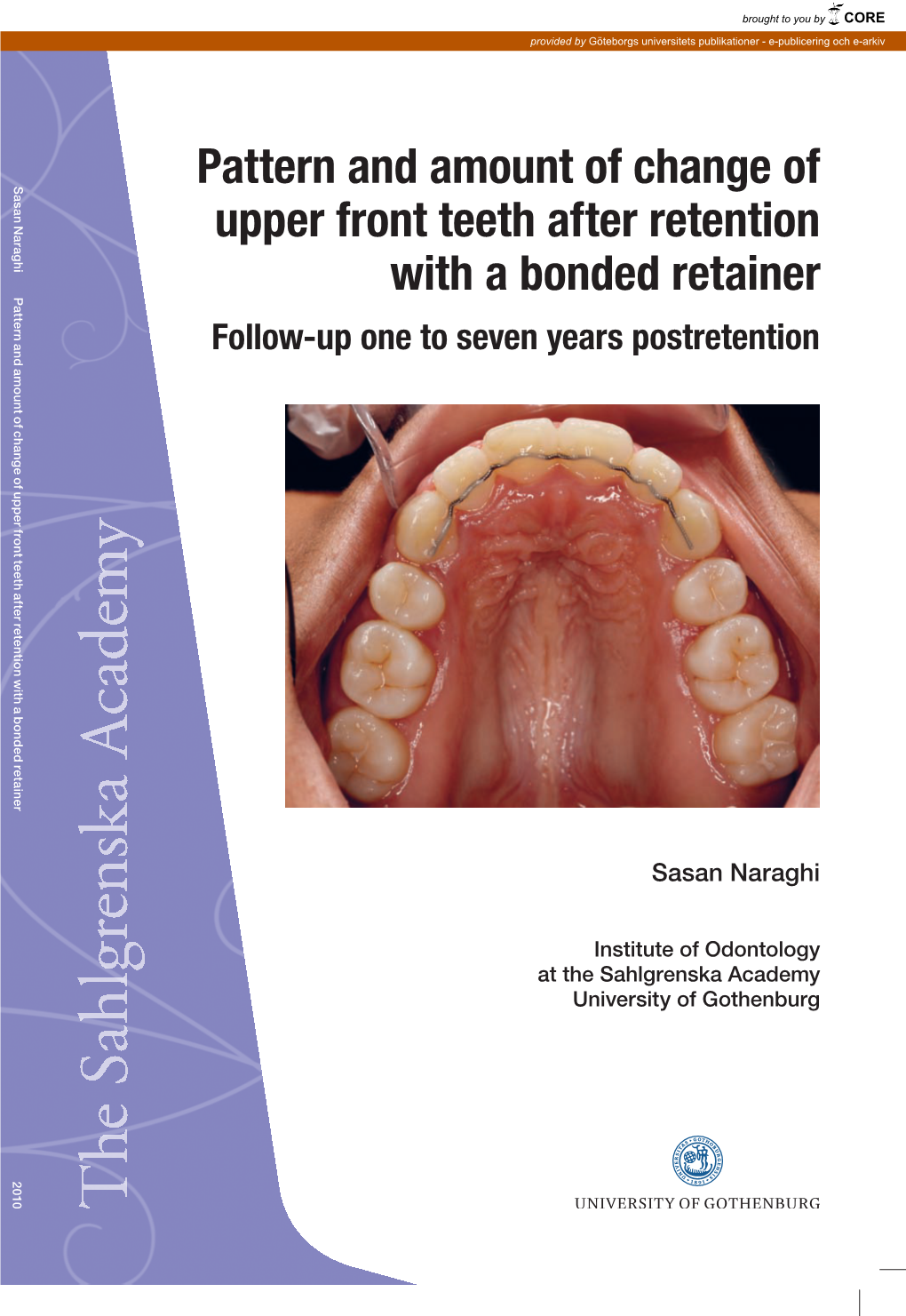 Pattern and Amount of Change of Upper Front Teeth After Retention with a Bonded Retainer 2010 G