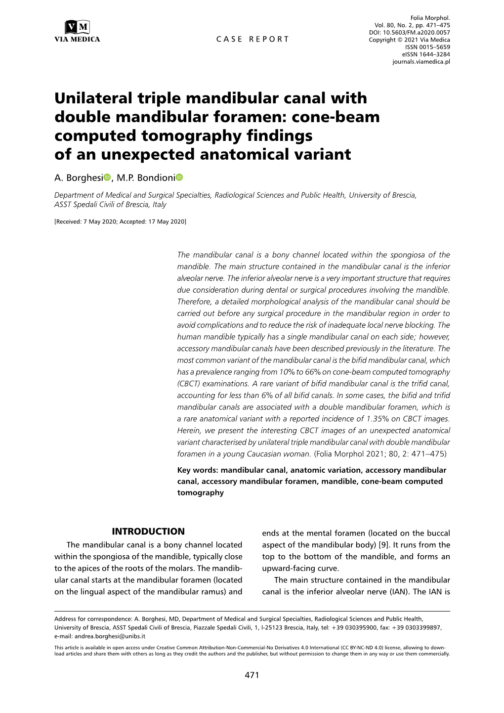 Cone-Beam Computed Tomography Findings of an Unexpected Anatomical Variant A