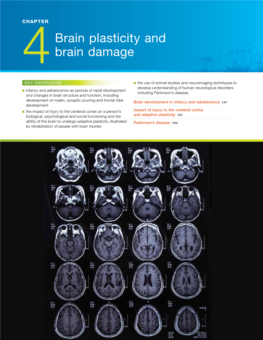 4Brain Plasticity and Brain Damage