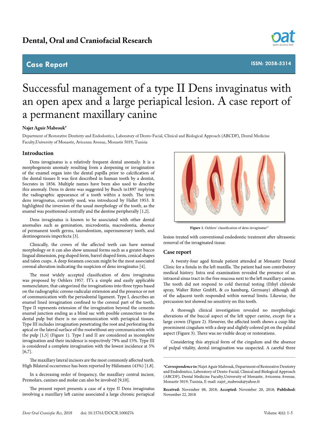 Successful Management of a Type II Dens Invaginatus with an Open Apex and a Large Periapical Lesion. a Case Report of a Permanen