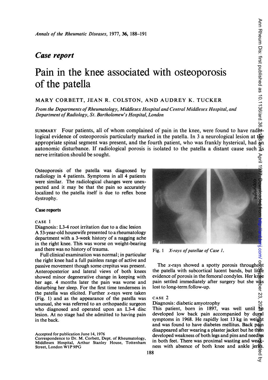 Pain in the Knee Associated with Osteoporosis of the Patella