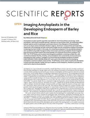 Imaging Amyloplasts in the Developing Endosperm of Barley and Rice