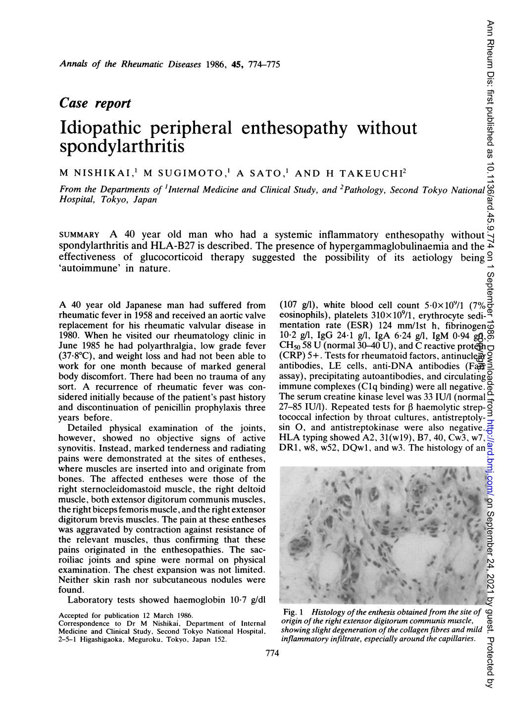 Idiopathic Peripheral Enthesopathy Without Spondylarthritis