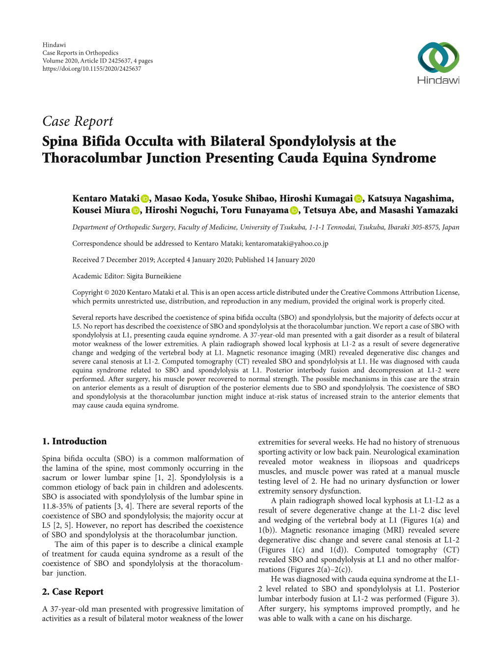 Spina Bifida Occulta with Bilateral Spondylolysis at the Thoracolumbar Junction Presenting Cauda Equina Syndrome