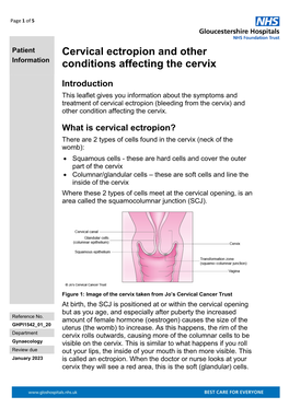 Cervical Ectropion and Other Conditions Affecting the Cervix