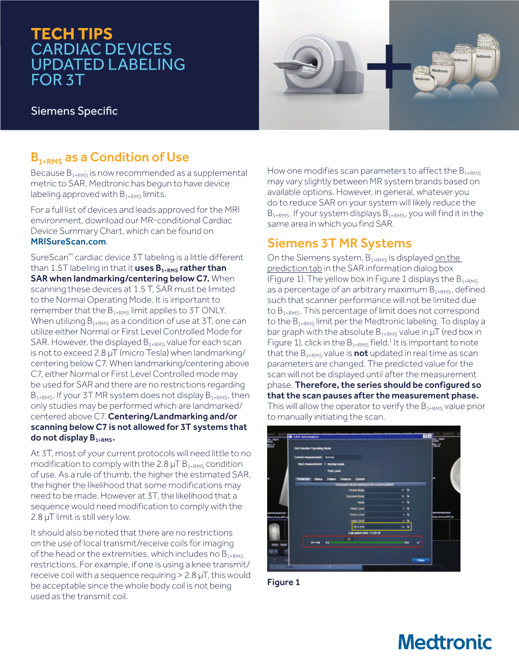 3T Tech Tips — Siemens Specific