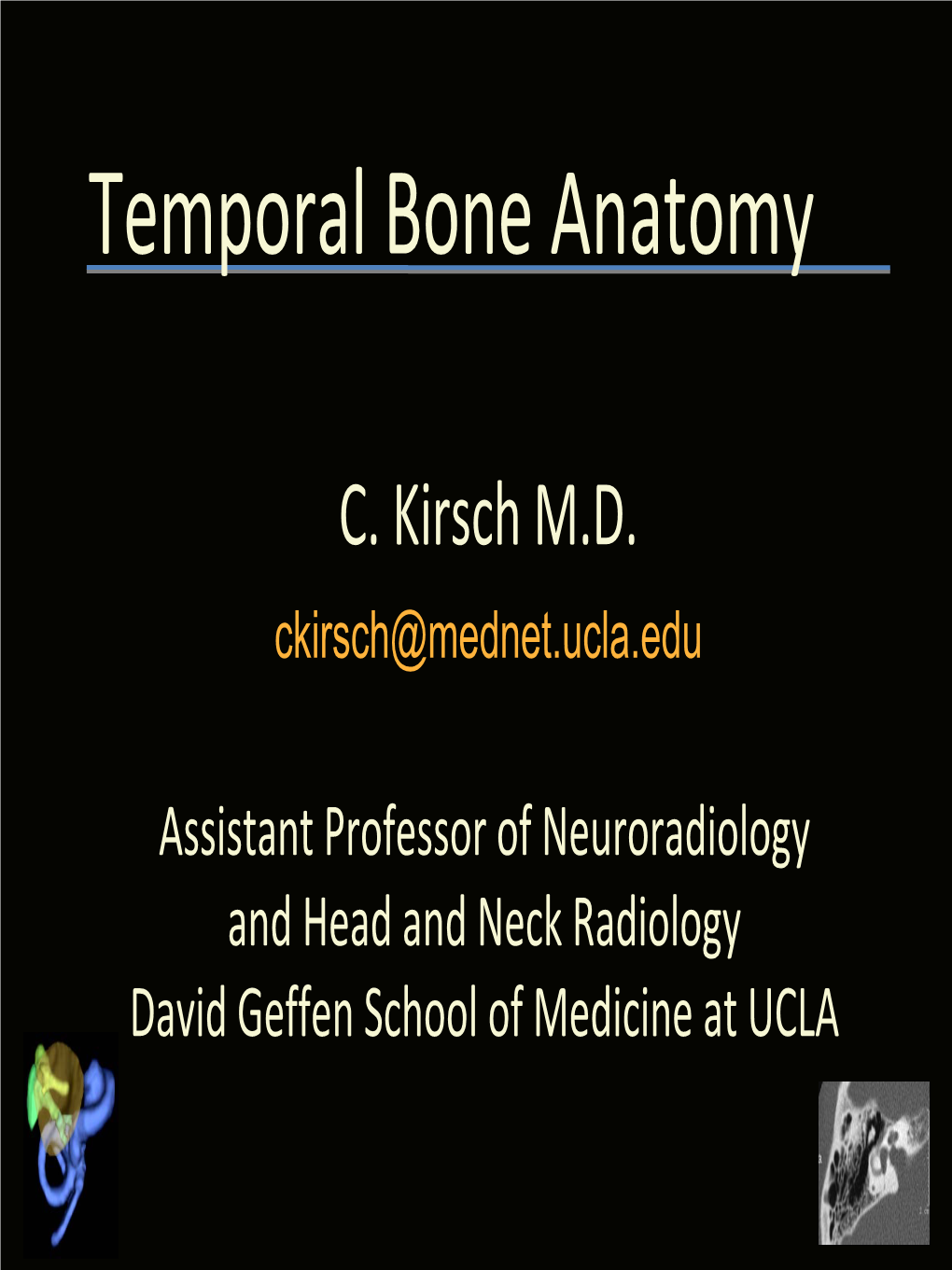 Temporal Bone Anatomy