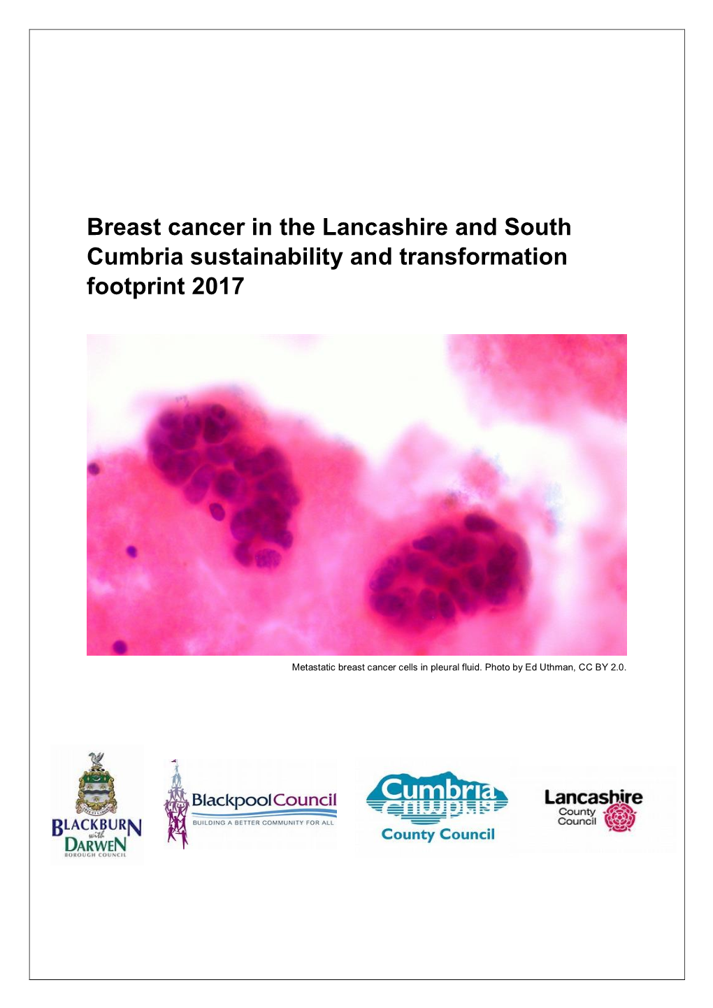 Breast Cancer in the Lancashire and South Cumbria Sustainability and Transformation Footprint 2017