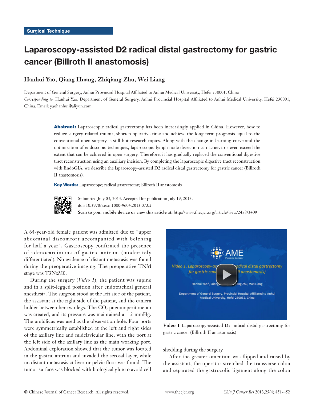 Laparoscopy-Assisted D2 Radical Distal Gastrectomy for Gastric Cancer (Billroth II Anastomosis)