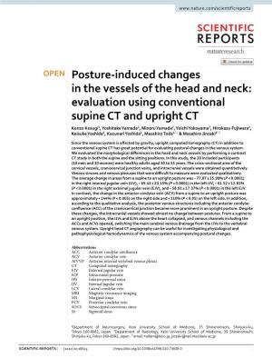 Posture-Induced Changes in the Vessels of the Head and Neck
