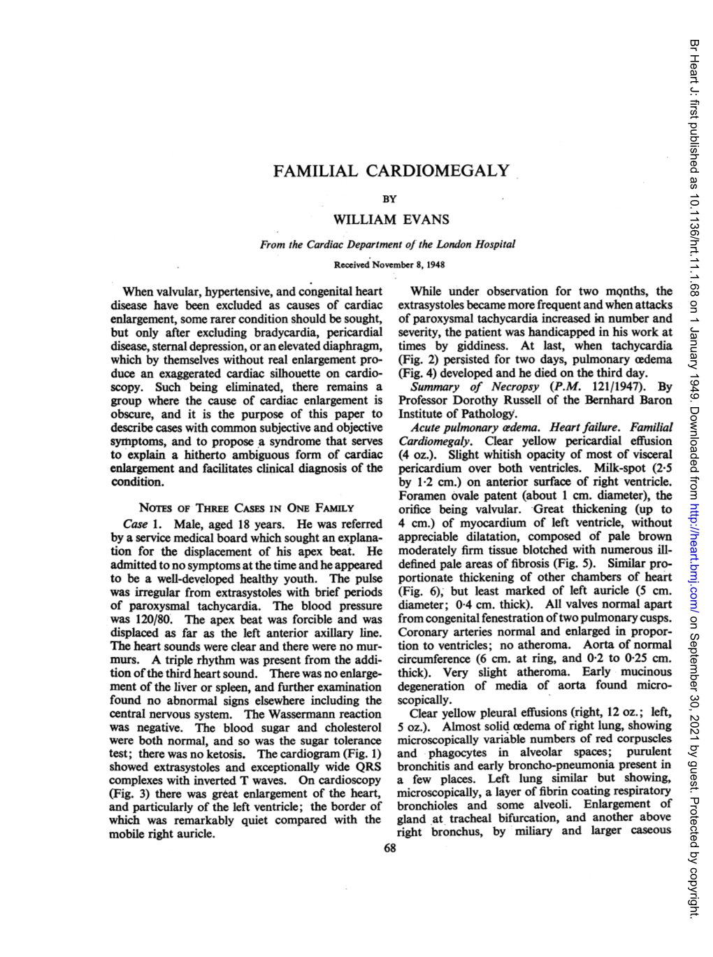 Familial Cardiomegaly