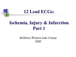 12 Lead Ecgs: Ischemia, Injury & Infarction Part 1