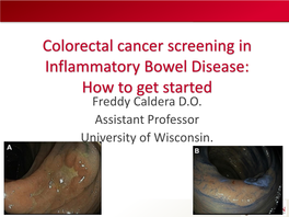 Atlas of Endoscopic Pictures of Chromoendoscopy and How to Get