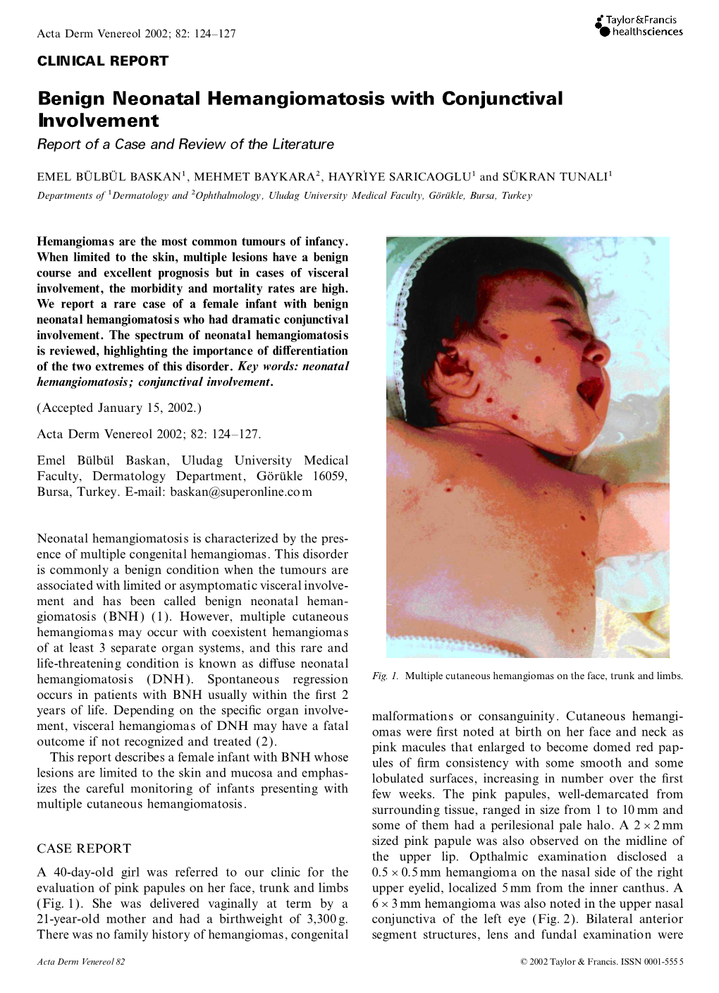 Benign Neonatal Hemangiomatosis with Conjunctival Involvement Report of a Case and Review of the Literature