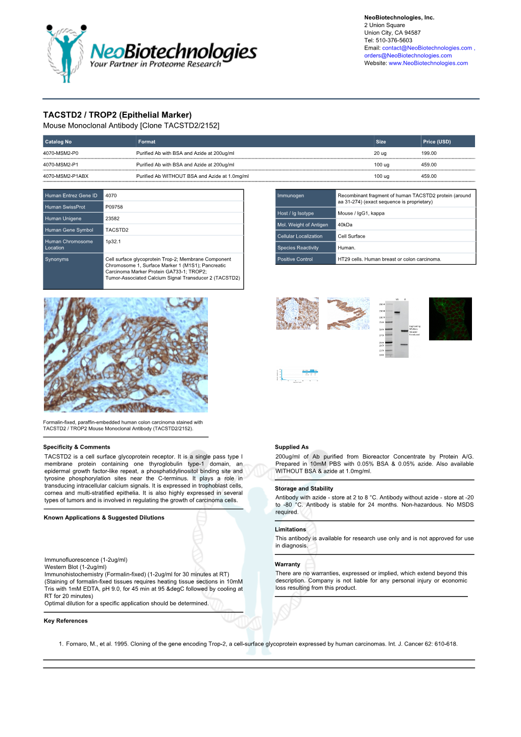 TACSTD2 / TROP2 (Epithelial Marker) Mouse Monoclonal Antibody [Clone TACSTD2/2152]