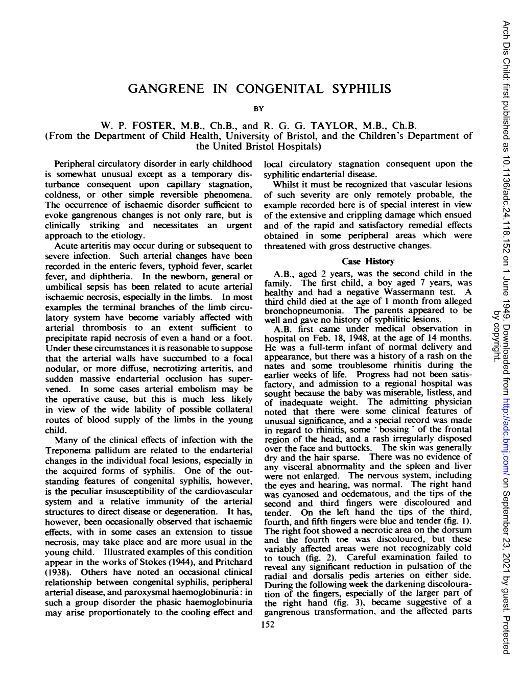 Gangrene in Congenital Syphilis