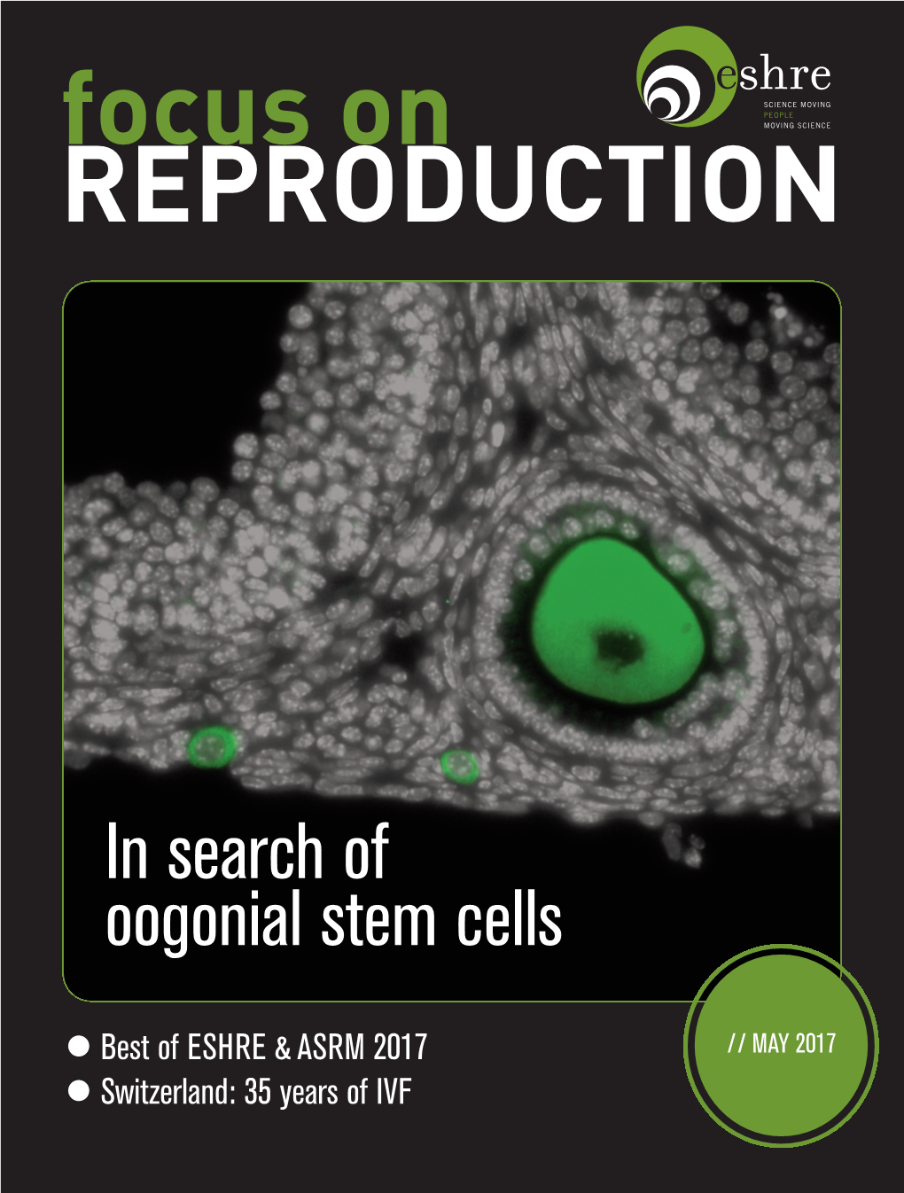 In Search of Oogonial Stem Cells