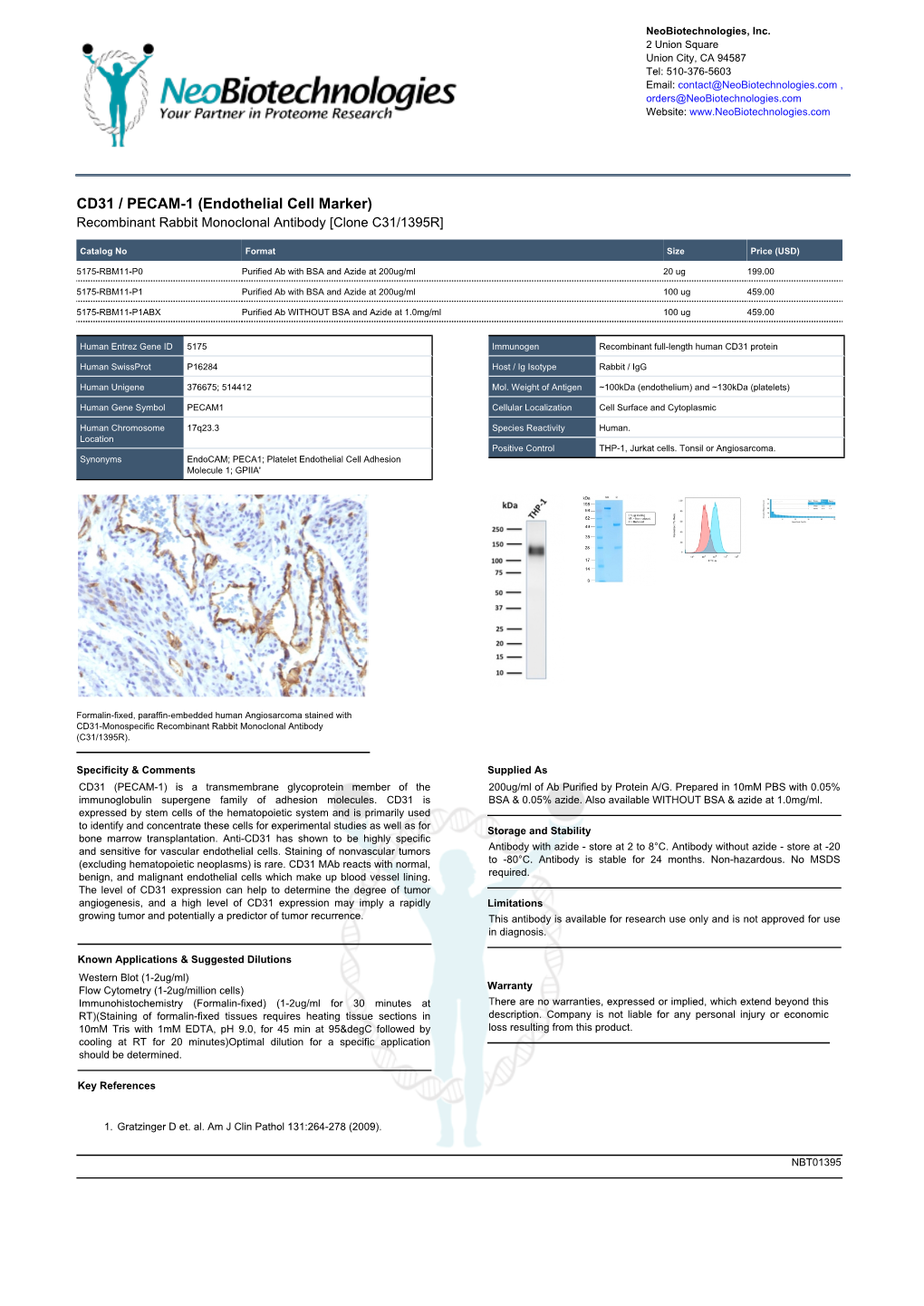 Endothelial Cell Marker) Recombinant Rabbit Monoclonal Antibody [Clone C31/1395R]