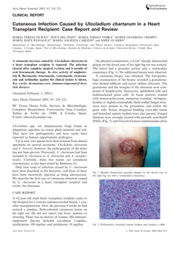 Cutaneous Infection Caused by Ulocladium Chartarum in a Heart Transplant Recipient: Case Report and Review