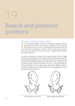 Breech and Posterior Positions 19 Breech and Posterior Positions
