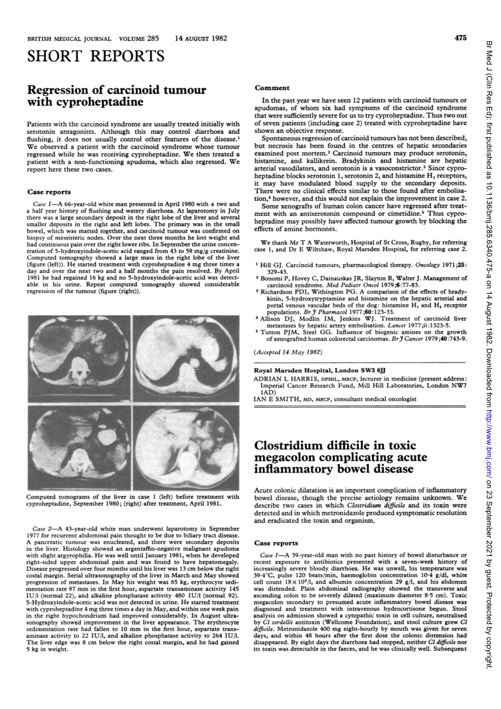 F Hlb.M:F..Dil...?:?. Clostridium Difficile in Toxic Megacolon Complicating Acute Inflammatory Bowel Disease on 23 September 2021 by Guest