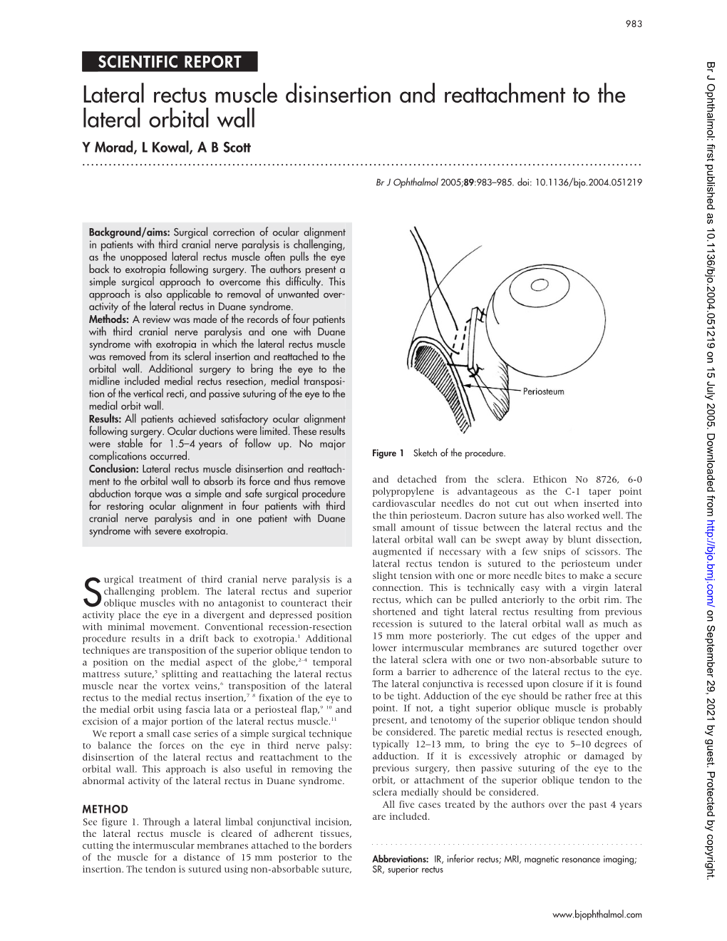 Lateral Rectus Muscle Disinsertion And Reattachment To The Lateral Orbital Wall Y Morad L Kowal