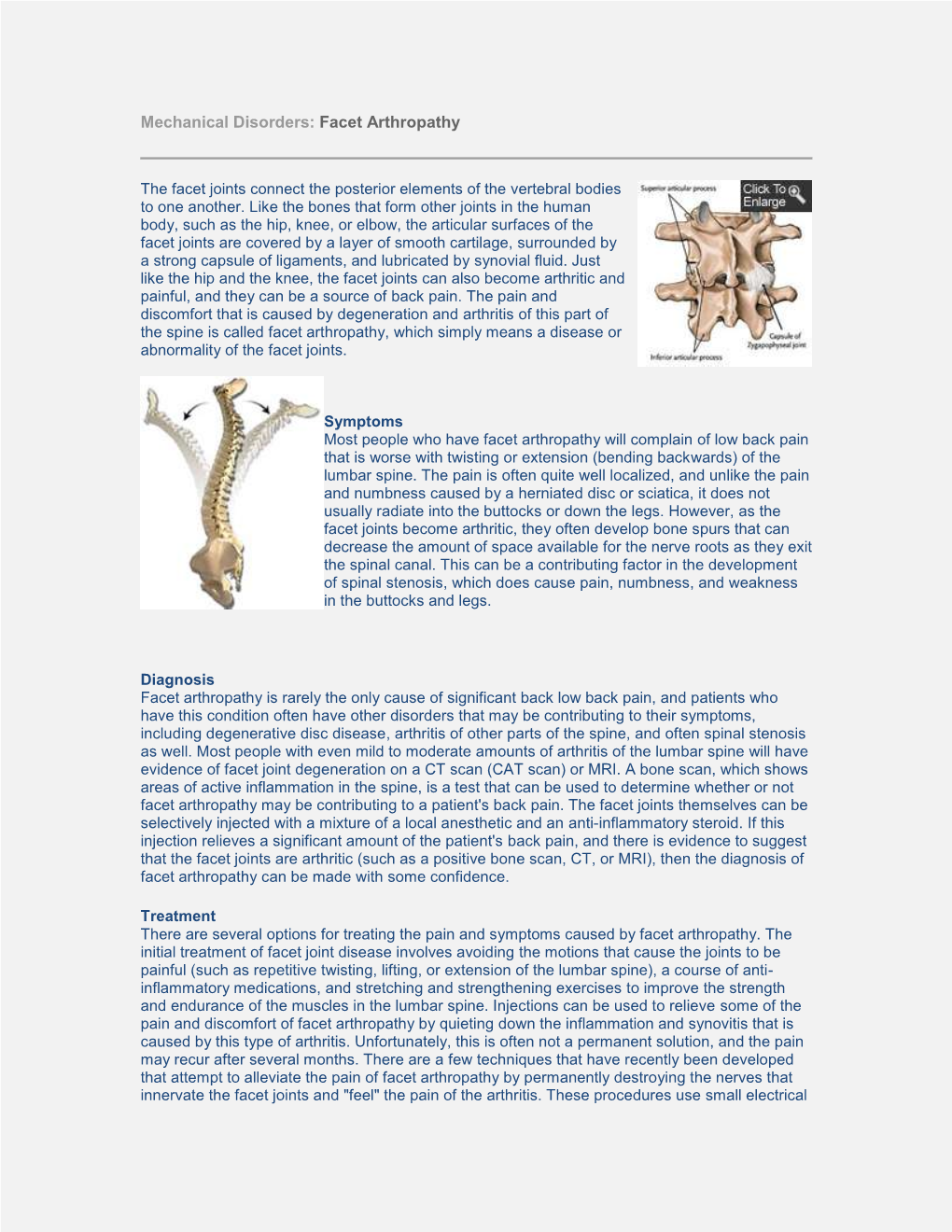 Mechanical Disorders: Facet Arthropathy