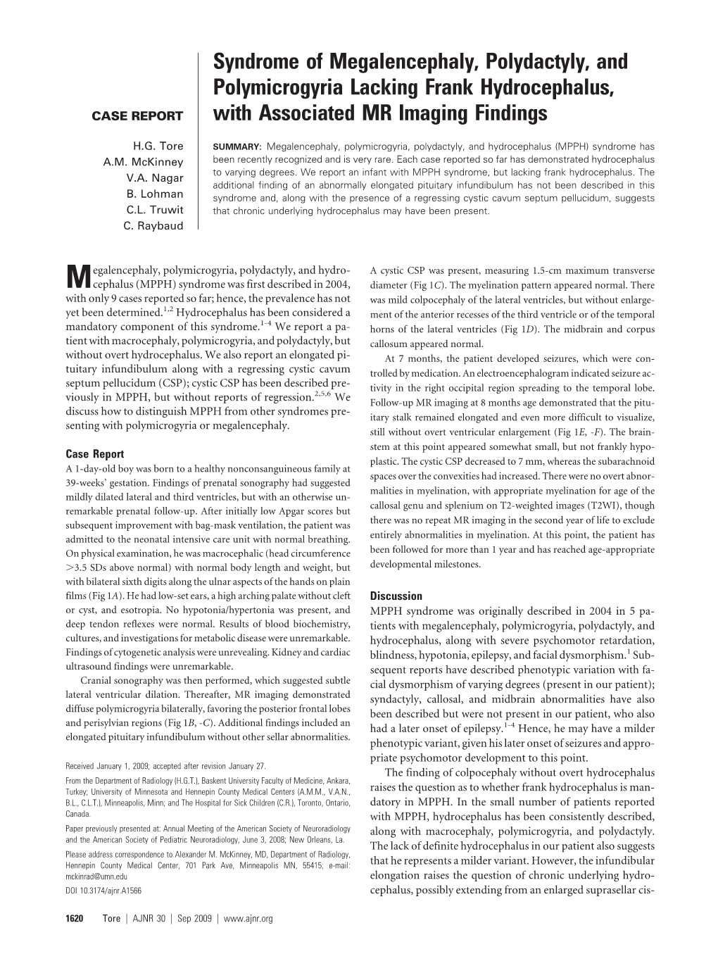 Syndrome of Megalencephaly, Polydactyly, and Polymicrogyria Lacking Frank Hydrocephalus, CASE REPORT with Associated MR Imaging Findings