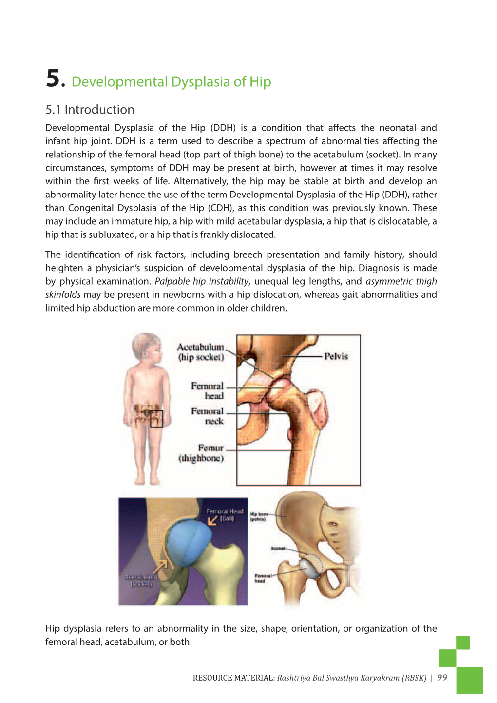 5. Developmental Dysplasia of Hip 5.1 Introduction Developmental Dysplasia of the Hip (DDH) Is a Condition That Affects the Neonatal and Infant Hip Joint