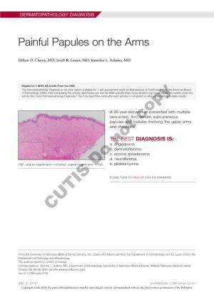 Painful Papules on the Arms