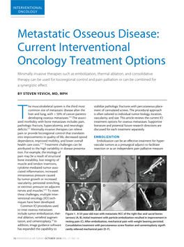 Metastatic Osseous Disease: Current Interventional Oncology Treatment Options