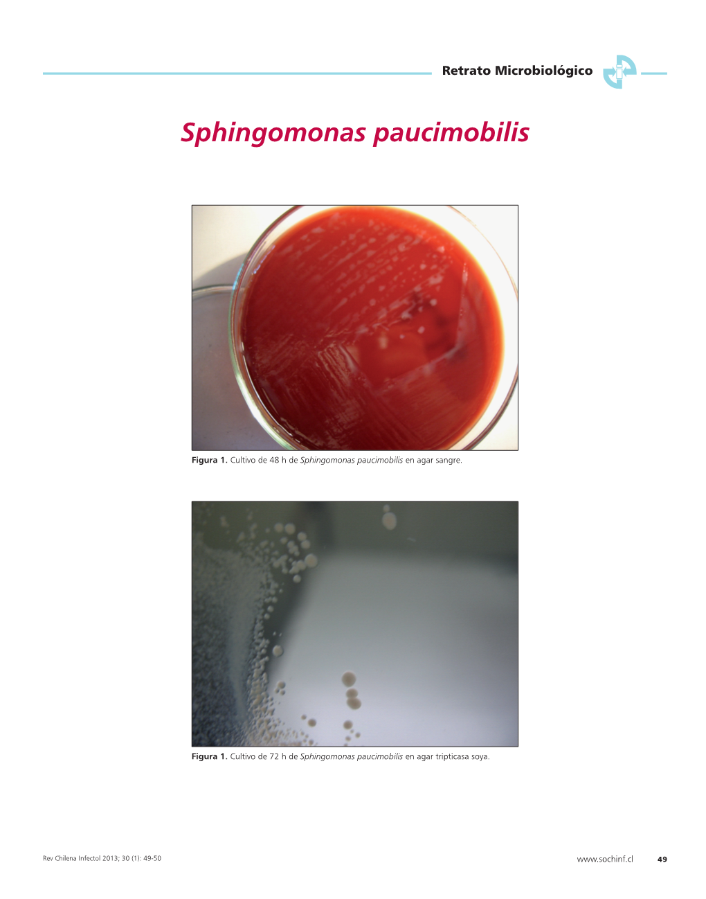 Sphingomonas Paucimobilis