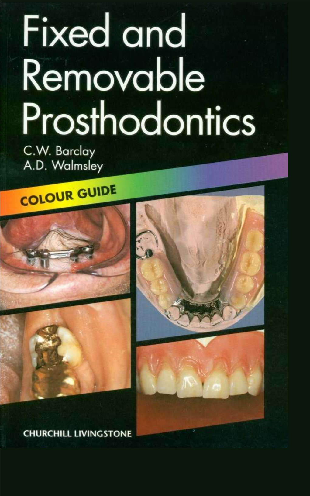 Fixed and Removable Prosthodontics