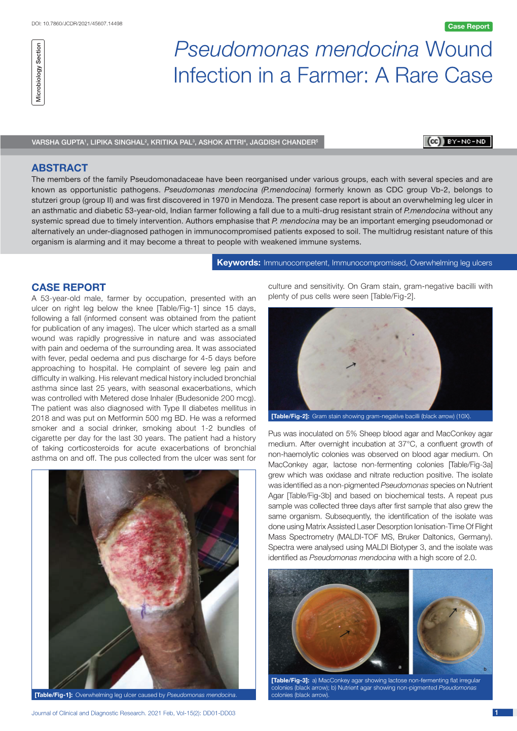 Pseudomonas Mendocina Wound Infection in a Farmer: a Rare Case Microbiology Section Microbiology