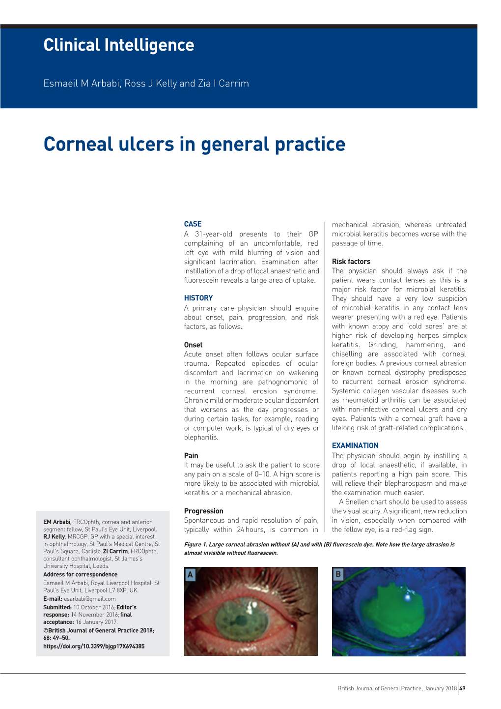 Corneal Ulcers in General Practice