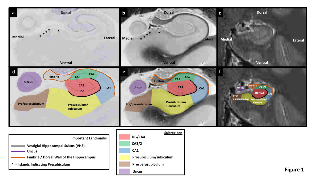 Figures 1-29 for Dalton Et Al. Brain and Neuroscience Advances