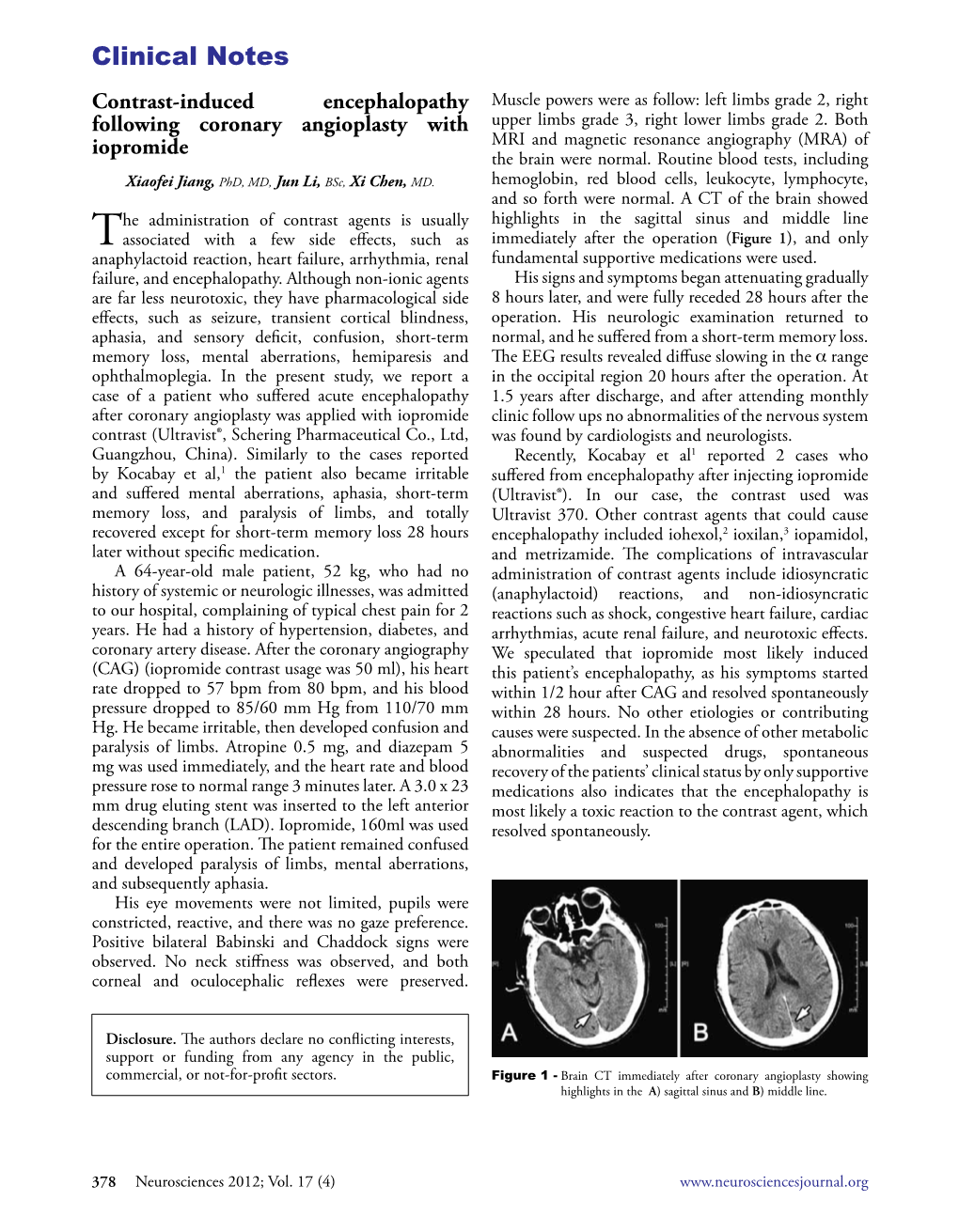 Contrast-Induced Encephalopathy Following Coronary Angioplasty with Iopromide