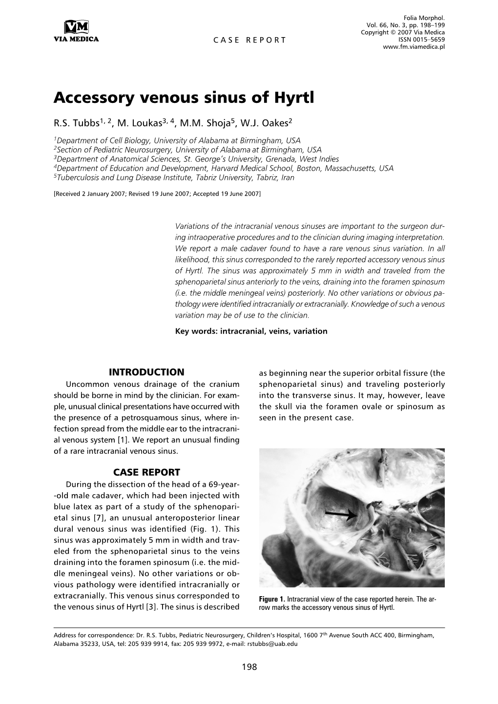 Accessory Venous Sinus of Hyrtl