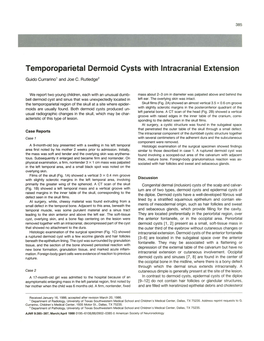 Temporoparietal Dermoid Cysts with Intracranial Extension
