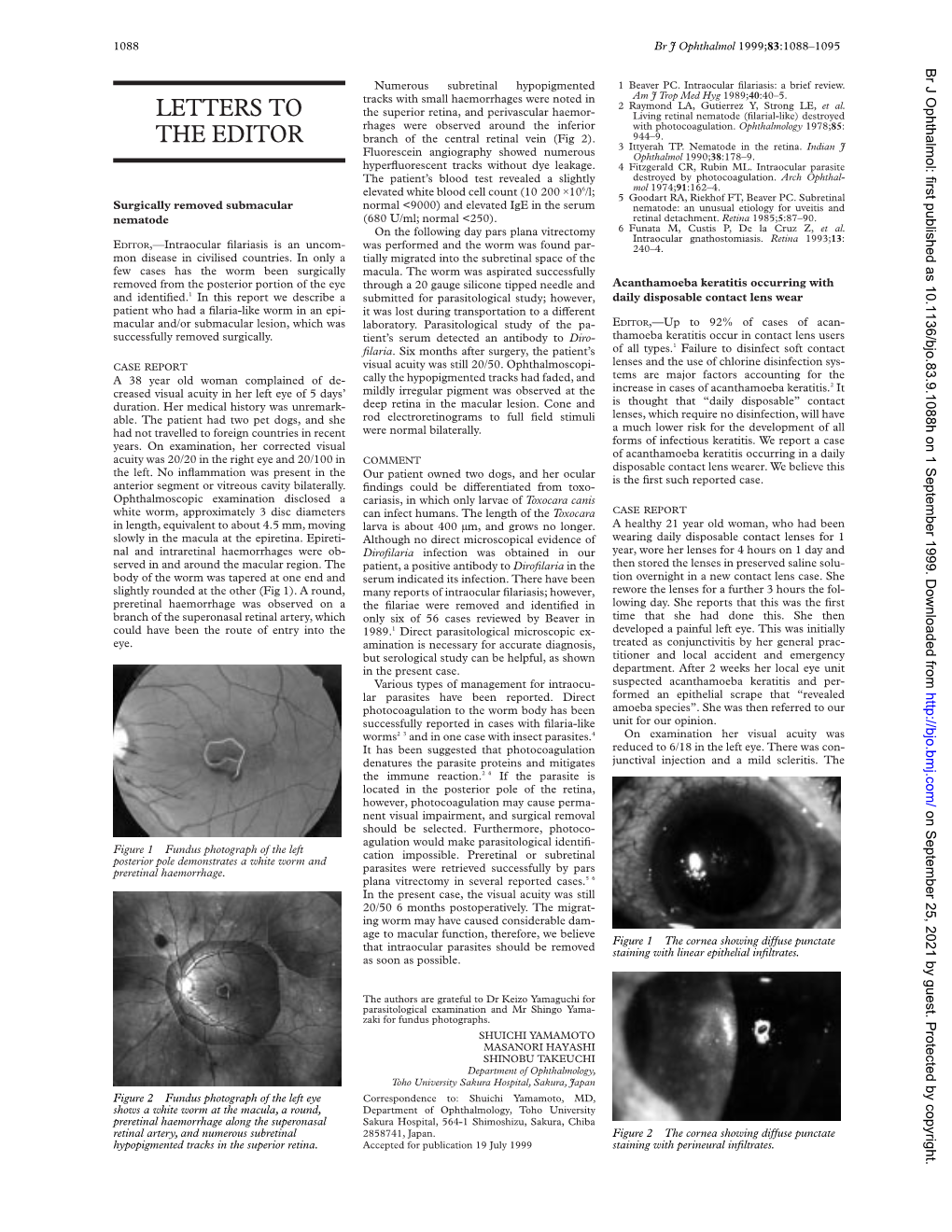 Somatostatin Scan Positive Gastrinoma Ocular Metastasis