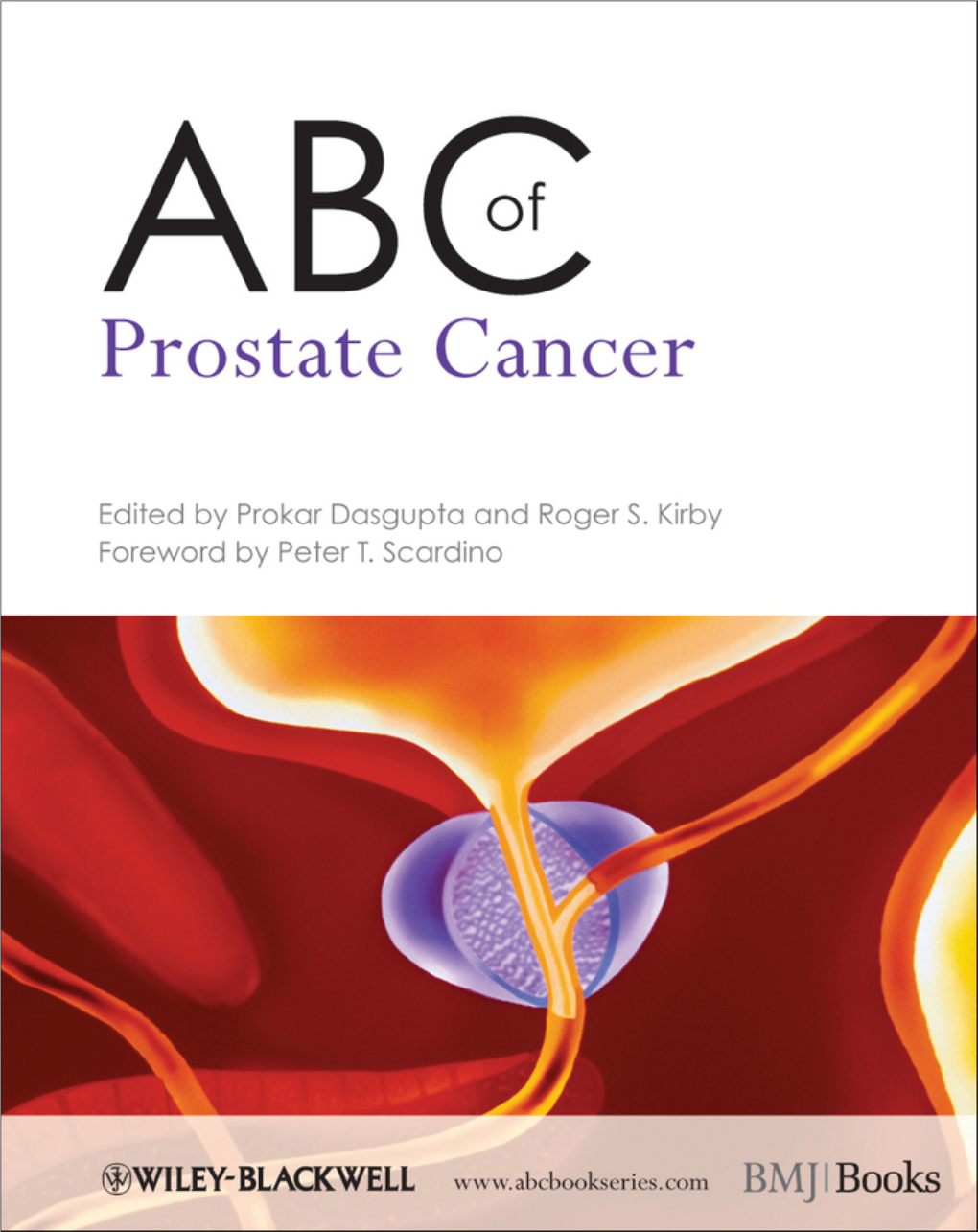 Prostate Cancer