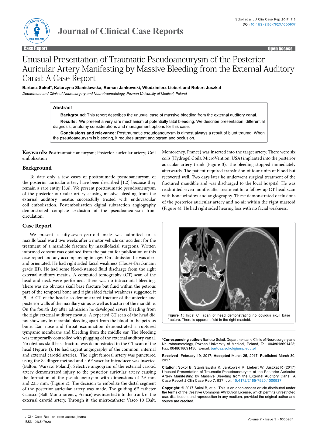 Unusual Presentation of Traumatic Pseudoaneurysm of the Posterior