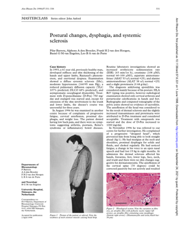 Postural Changes, Dysphagia, and Systemic Sclerosis