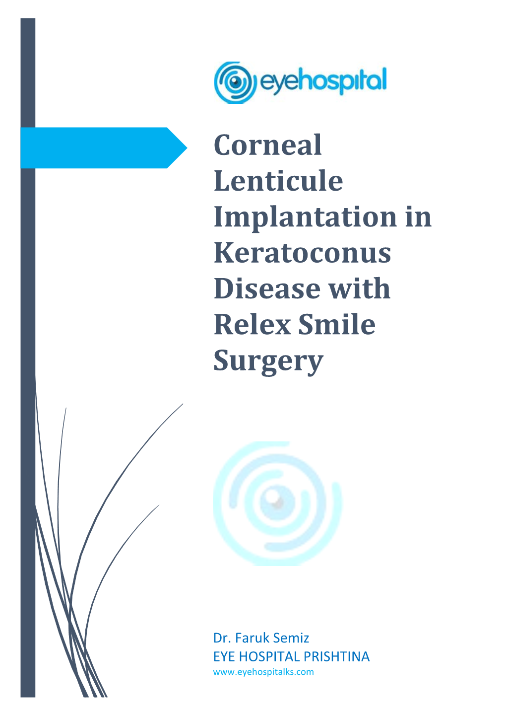 Corneal Lenticule Implantation in Keratoconus Disease with Relex Smile Surgery