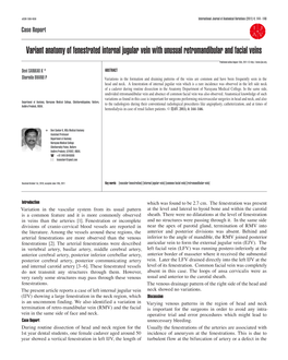 Variant Anatomy of Fenestrated Internal Jugular Vein with Unusual Retromandibular and Facial Veins