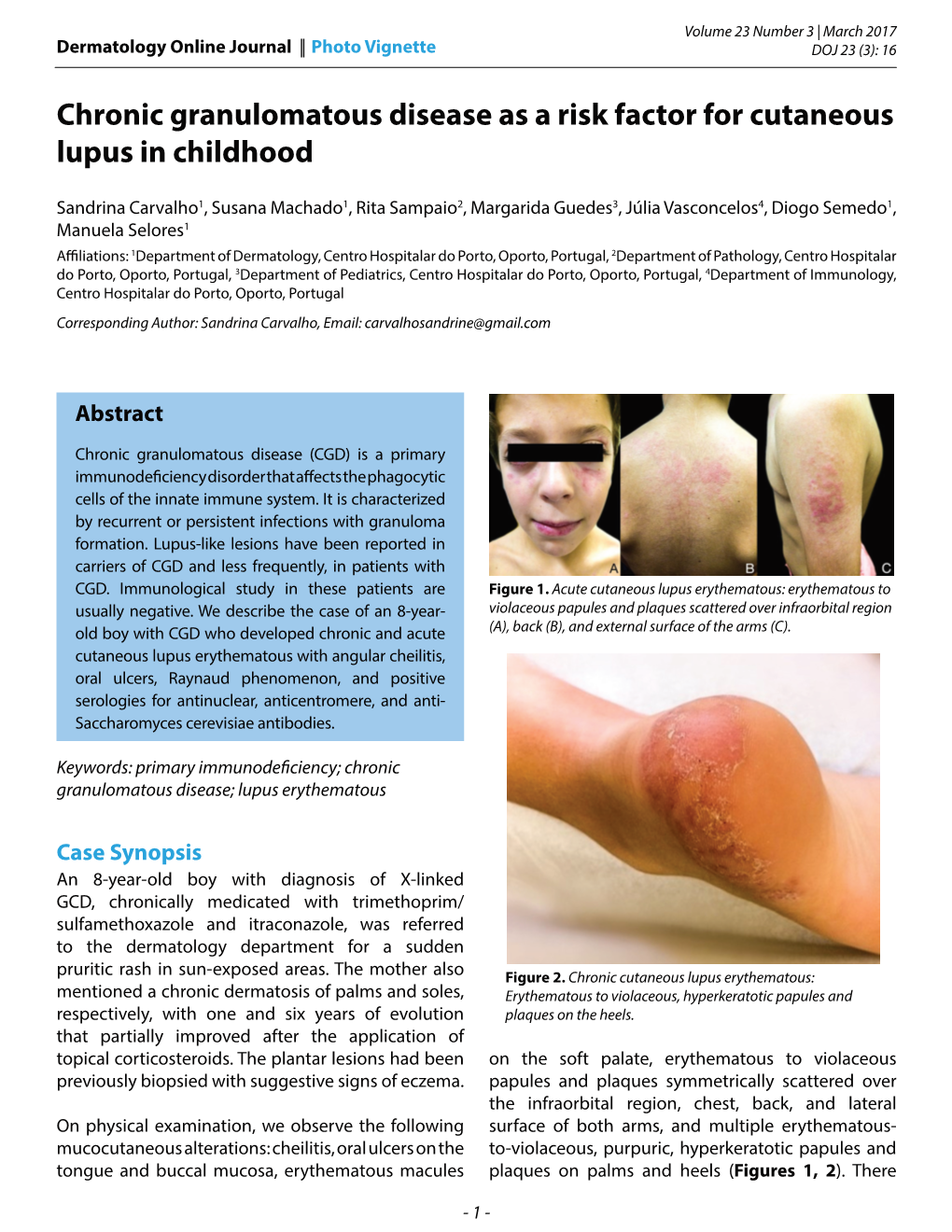 Chronic Granulomatous Disease As a Risk Factor for Cutaneous Lupus in Childhood