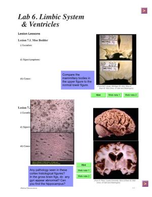 Lab 6. Limbic System & Ventricles